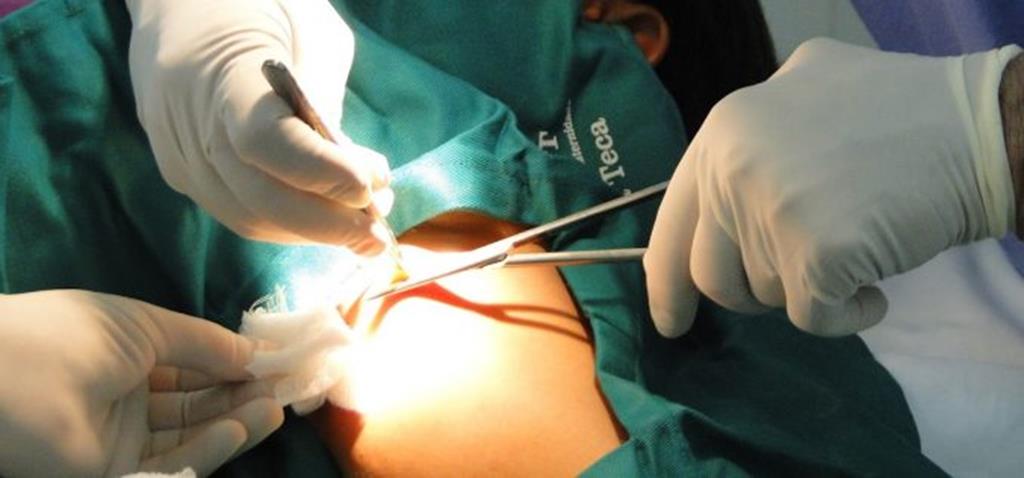 Secretaria de Saúde de Campo Verde realiza “Semana das Pequenas Cirurgias”